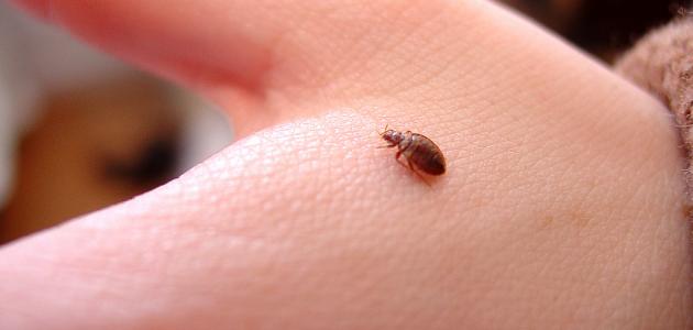 لدغاته-تسبب-الحكة-والاحمرار.-كيف-يمكن-التخلص-من-بق-الفراش؟