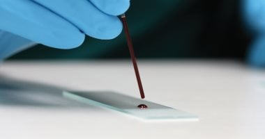 اختبار يتوقع حدوث حالة قلبية مفاجئة عند الأطفال قبل وقوعها بخمس سنوات اختبار يتوقع حدوث حالة قلبية مفاجئة عند الأطفال قبل وقوعها بخمس سنوات