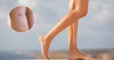 يستلزم إجراء الفحص فوراً: ست علامات مبكرة على انسداد شرايين الساقين يستلزم إجراء الفحص فوراً: ست علامات مبكرة على انسداد شرايين الساقين