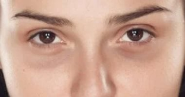 بعد الاستيقاظ مبكرًا للمدرسة.. 4 خطوات تكافح ظهور الهالات السوداء عند الأمهات 